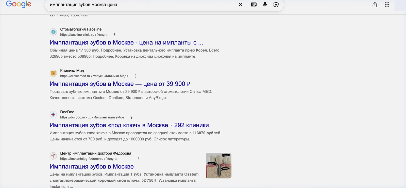 Google по запросу «имплантация зубов москва цена»: в органической выдаче рядом с клиниками стоит агрегатор DocDoc с 292 клиниками